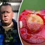 Prečo sú čerešne červivé: neočakávaný dôvod